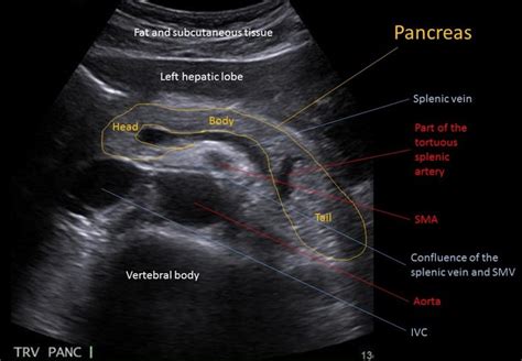 Cours Us Abdomen Pancréas