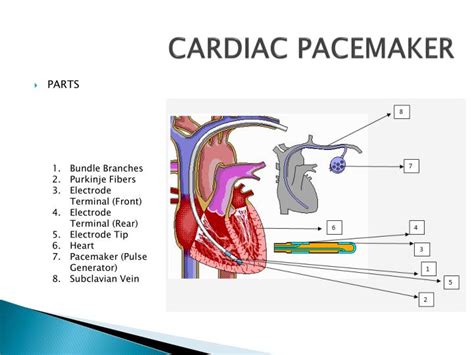 Ppt Cardiac Pacemaker Powerpoint Presentation Id6864227