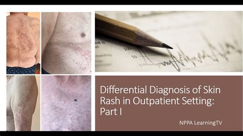 Skin Rashes Ncp