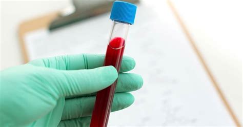 Blood Test Lipid Panel