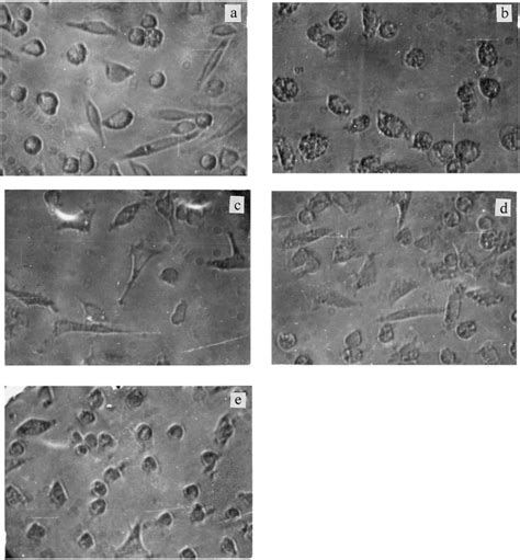 Macrophage Colony Stimulating Factor Reduces Tert Butyl Hydroperoxide