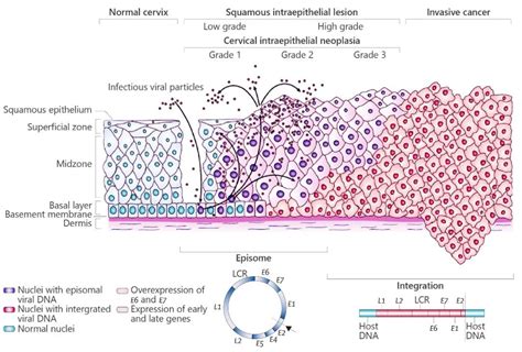 Mce Hpv 疫苗要不要打？ 技术前沿 生物在线 Lab On Web