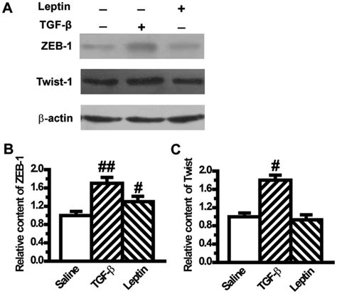 Leptin Induces Epithelial To Mesenchymal Transition Via Activation Of