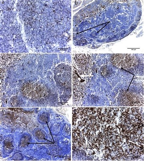 Light Micrographs Display Immunohistochemical Staining Of Cd20