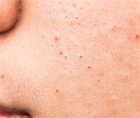 common dermatological  health conditions affecting aesthetic