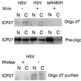 Protein Synthesis In Cells Infected With HSV Vero Cells Were Either