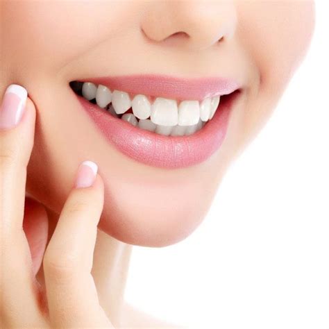 Sonrisa Gingival Centro de cirugía Althea Medicina estética Mérida