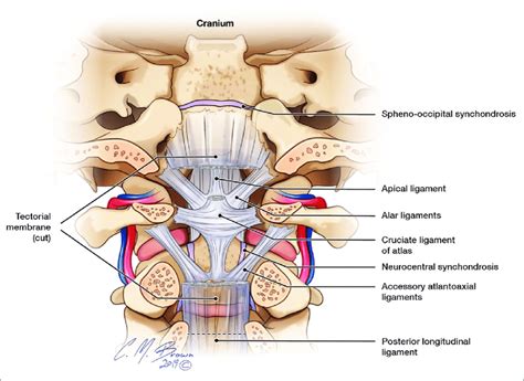 Transverse Ligament Cervical Spine