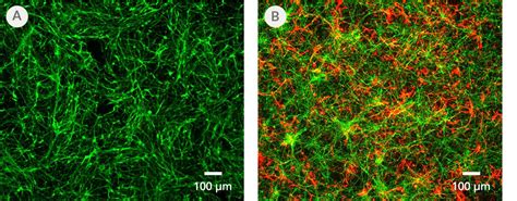 STEMdiff Astrocyte Differentiation Kit STEMCELL Technologies