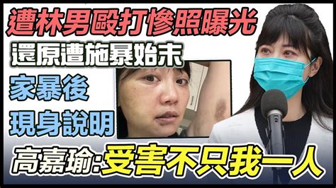 【完整版】勇敢面對！高嘉瑜遭家暴後 記者會首發聲｜三立新聞網 Youtube