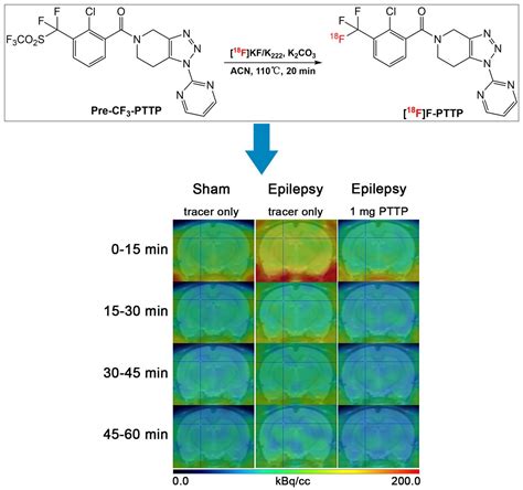 P2X7 Receptor Targeting Radioligand 18F F PTTP Longitudinal Pilot PET