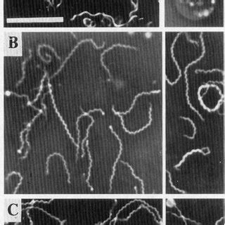 Alkaliphilic spirochetes under an anoptral microscope in a wet mount.... | Download Scientific ...