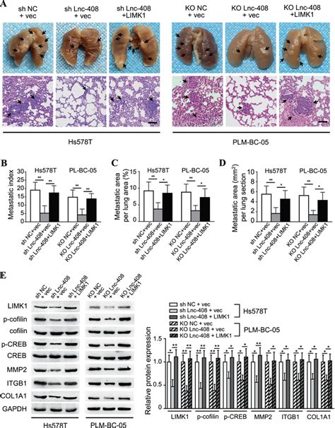 Lnc Promotes Bc Cell Metastasis In Vivo Via Limk A Representative