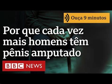 Por Que Cada Vez Mais Homens T M O P Nis Amputado Website De Pedro