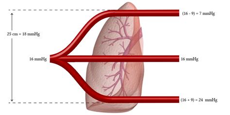 Physiological Characteristics Of Pulmonary Blood Vessels Deranged