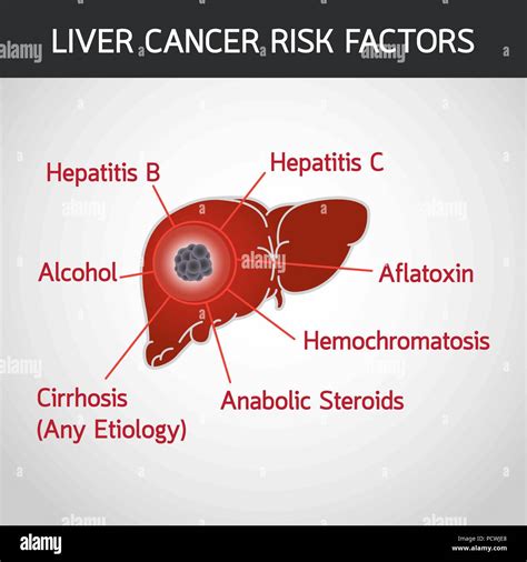 Los factores de riesgo de cáncer de hígado del vector logo icono