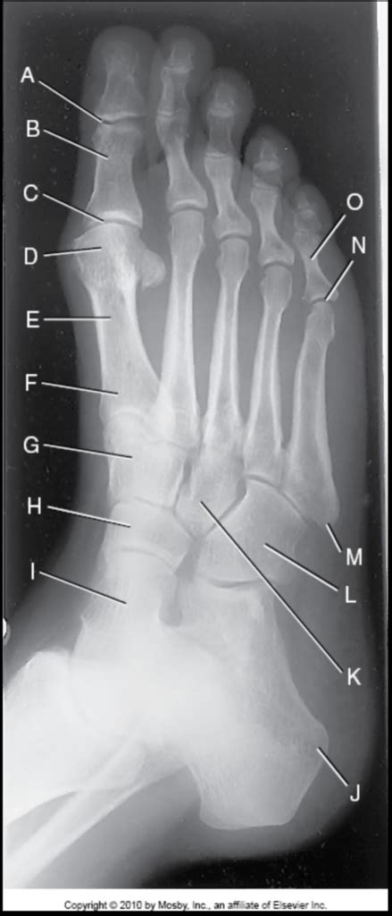 Foot x-ray Diagram | Quizlet