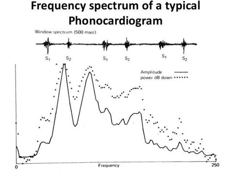 Phonocardiogram Classification | Intel DevMesh | Aritra Roy Gosthipaty ...