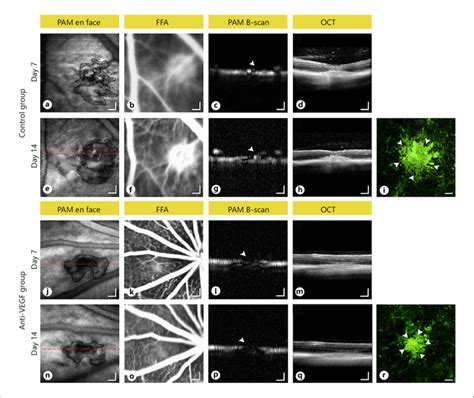 Multimodal Imaging Of Laser Induced Choroidal Neovascularization CNV