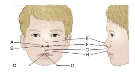 Facial Landmarks Diagram Quizlet