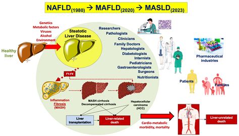 Ijms Free Full Text Metabolic Dysfunctionassociated Steatotic Liver Disease From