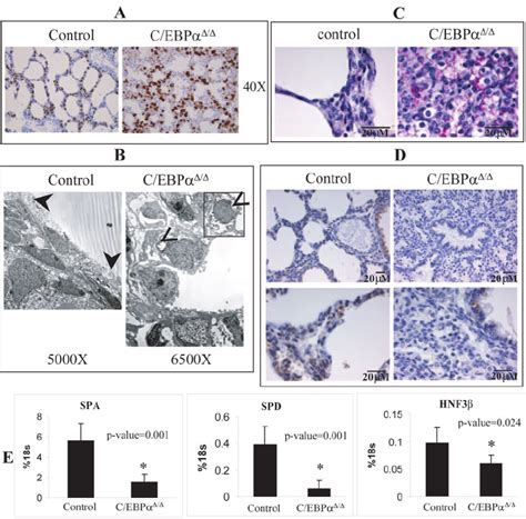 C/EBP ␣ ⌬ / ⌬ mouse alveolar epithelial cells are immature type II ...