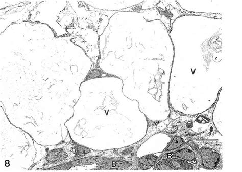 Electron Micrograph Liver Lipomatous Lesion In A B6c3f1 Mouse Note Download Scientific