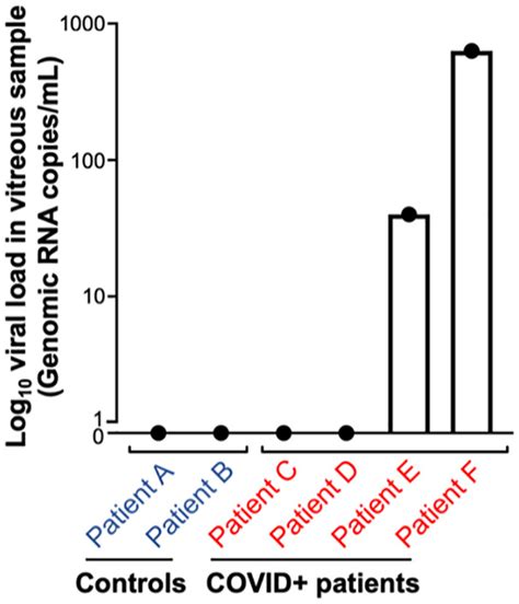 Sars Cov Rna Detected In Vitreous Samples Obtained At Autopsy