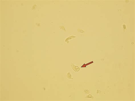 Transitional Epithelial Cells