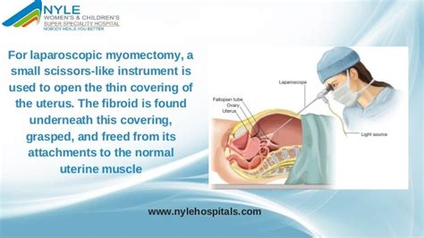 Uterine Fibroid Removal In Kerala Laparoscopic Fibroid Removal Surg