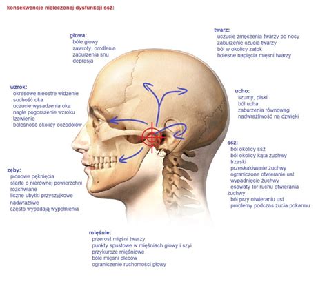 Szumy uszne leczenie Terapia Stawów skroniowo żuchwowych