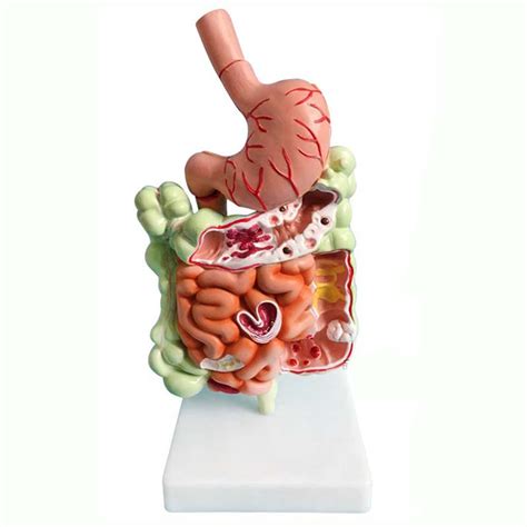 Buy Human Digestive System Stomach Anatomy Model Pathological Large