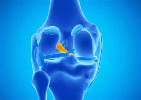 Acl Insufficiency Anterior Knee Instability Knee Instability