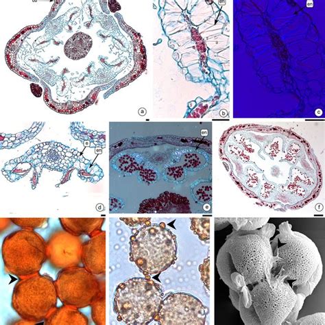 Anthers In Section Transversal Of Pistillate Flower Pf And Staminate