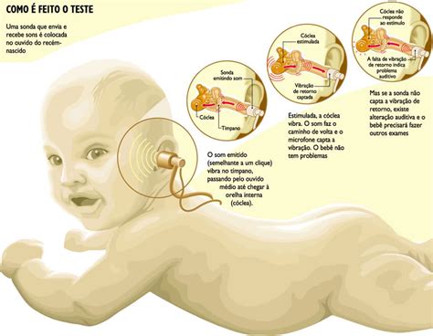 Triagem Auditiva Neonatal Teste Da Orelhinha Introdu O A Fonoaudiologia