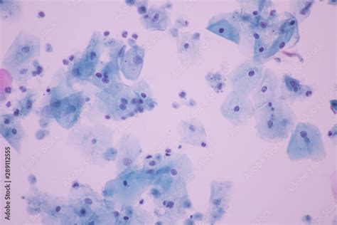 Trichomonas In Pap Smear On White Background View In Microscopicmedical Backgroundcytology And