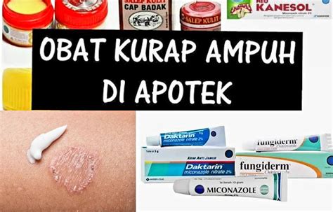 mujarab  rekomendasi obat kurap   ditemukan  apotek