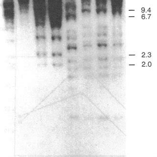 Hybrid Selection Of Uracil Dna Glycosylase Mrna Human Placental