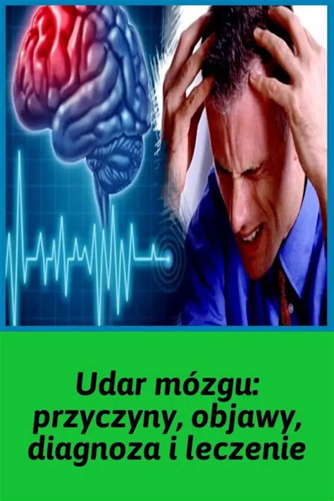 Udar mózgu Zobacz przyczyny objawy diagnozę i leczenie