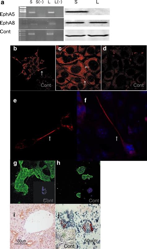 A Expressions Of Ephrin Eph A And Epha Were Detected By Rt Pcr