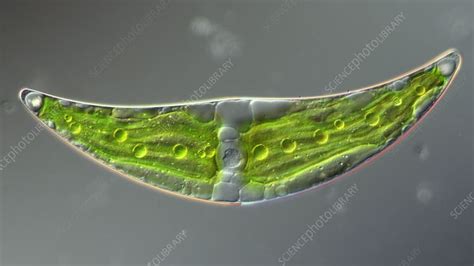 Closterium Lunula Green Algae Light Microscopy Stock Video Clip