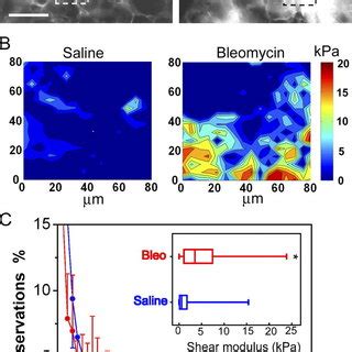 PDF Feedback Amplification Of Fibrosis Through Matrix Stiffening And