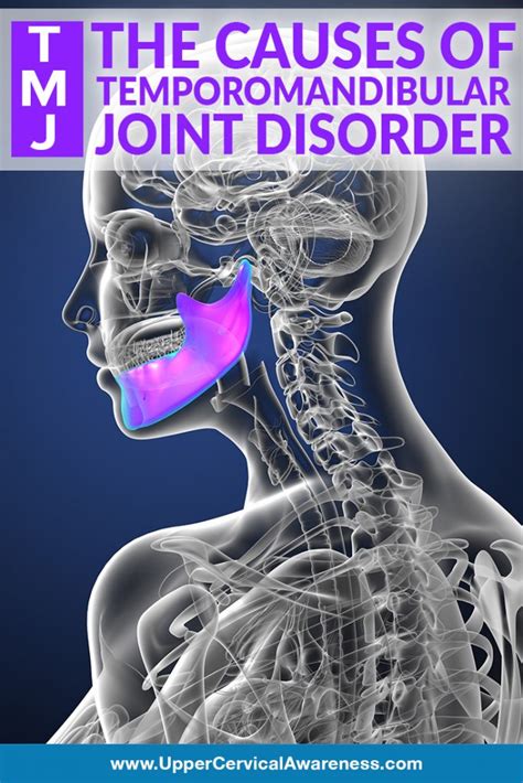 Origin Of Temporomandibular Joint Disorder Upper Cervical Awareness