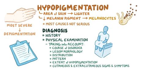 Hypopigmentation skin disorders: Clinical: Video | Osmosis