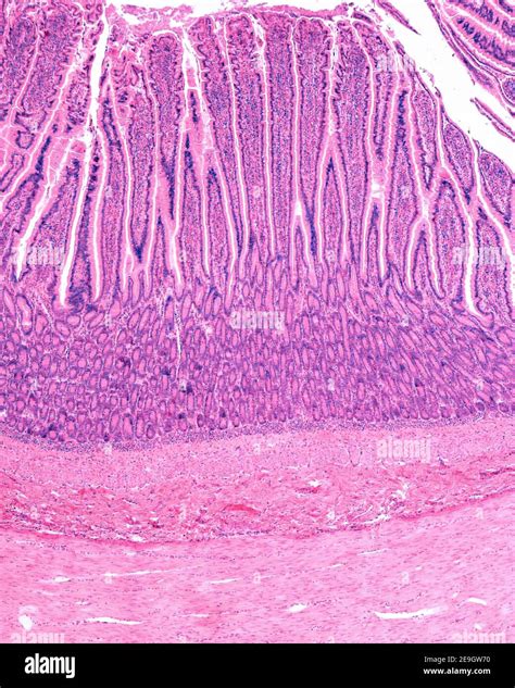 Layers Of The Small Intestine Wall Showing From Top To Bottom Mucosa