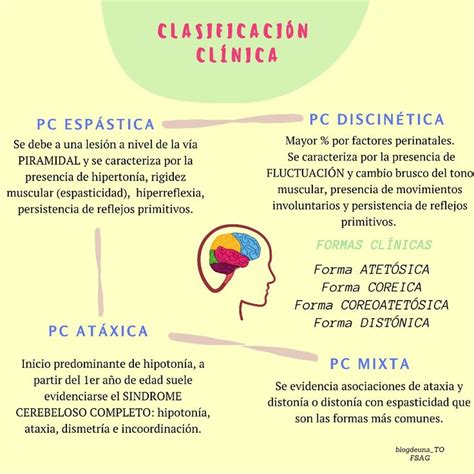 Parálisis Cerebral Mixta