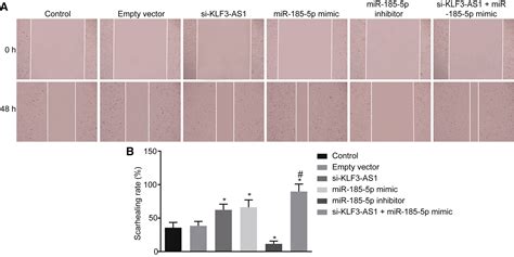 Lncrna Klf As Suppresses Cell Migration And Invasion In Escc By