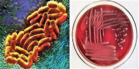 Klebsiella Pneumoniae Emb