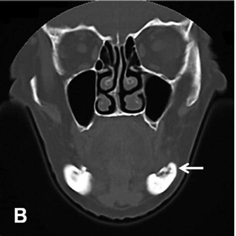 Pdf Radiographic Characteristics Of Chronic Diffuse Sclerosing