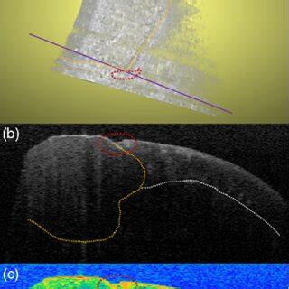 Oct Scan Of The Same Sample Depicted In Fig A C Scan Of The Tooth